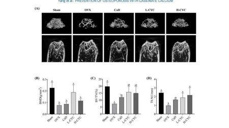 【喜讯】产学研成果：骨质疏松防治获新突破